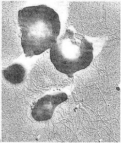 Thermococcus litoralis Archeabacteria Examples Classification