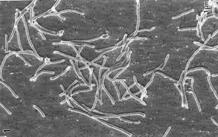 Thermus aquaticus Biodiversity of Life Archaebacteria