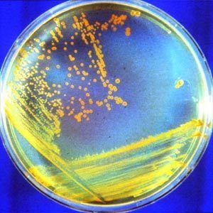 Thermus aquaticus Putting Thermus Aquaticus and Other Extremophiles to Work How