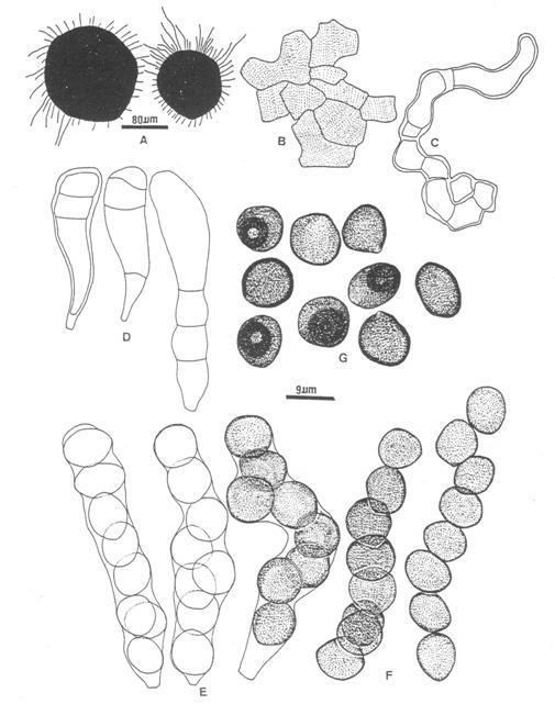 Thielavia Ascomycota gtgt Ascomycetes gtgt Phyllachorales gtgt Thielavia pingtungia