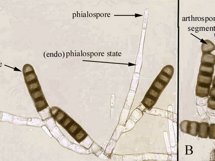 Thielaviopsis basicola Thielaviopsis basicola labelled micrographs