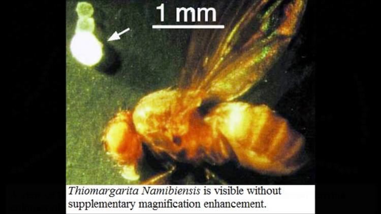 The white spot is the Thiomargarita namibiensis about the same size as the head of a fruit fly