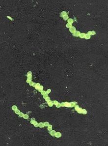 Stained microphotograph of Thiomargarita namibiensis bacteria