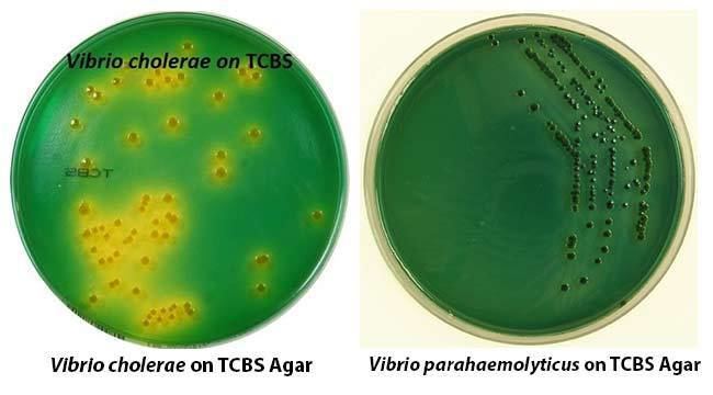 Thiosulfate-citrate-bile salts-sucrose agar wwwmicrobiologyinfocomwpcontentuploads20151