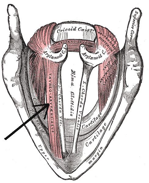 Thyroepiglottic muscle