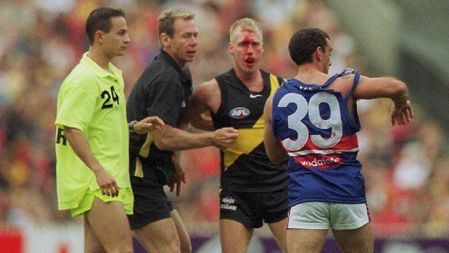 Tony Liberatore Tony Liberatore tells Fox Footy39s Open Mike he punched
