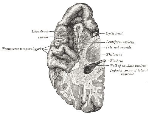 Transverse temporal gyrus