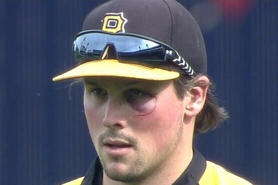 Travis Snider Pirates Travis Snider Sports a Black Eye After BenchesClearing