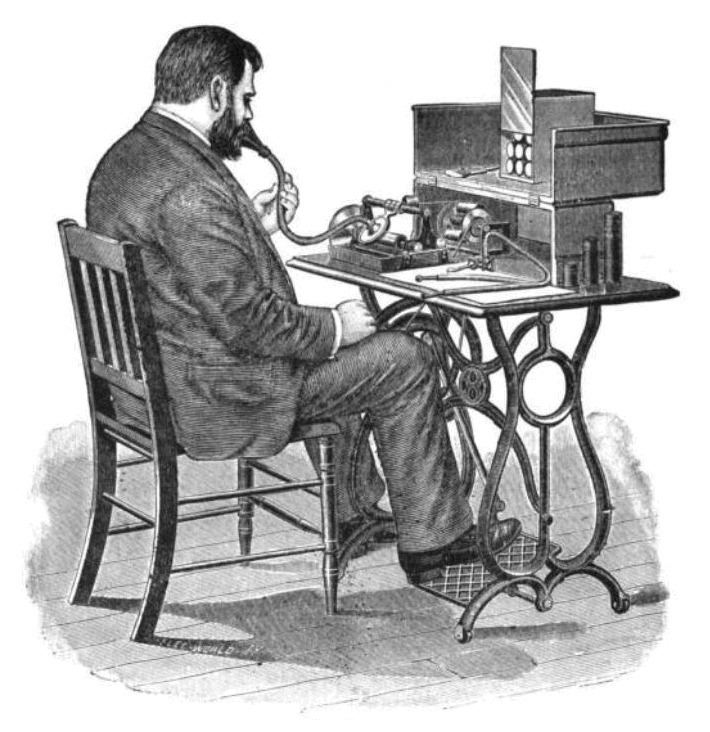 Treadle