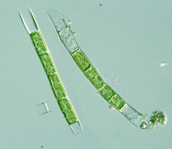 Tribonema Protist Images Tribonema