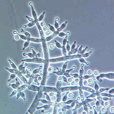 Trichoderma harzianum Trichoderma harzianum wwwmicrobiologybytescom Flickr