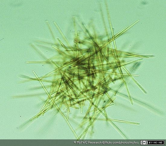 Trichodesmium Cyanobacteria Trichodesmium spp MarineBioorg