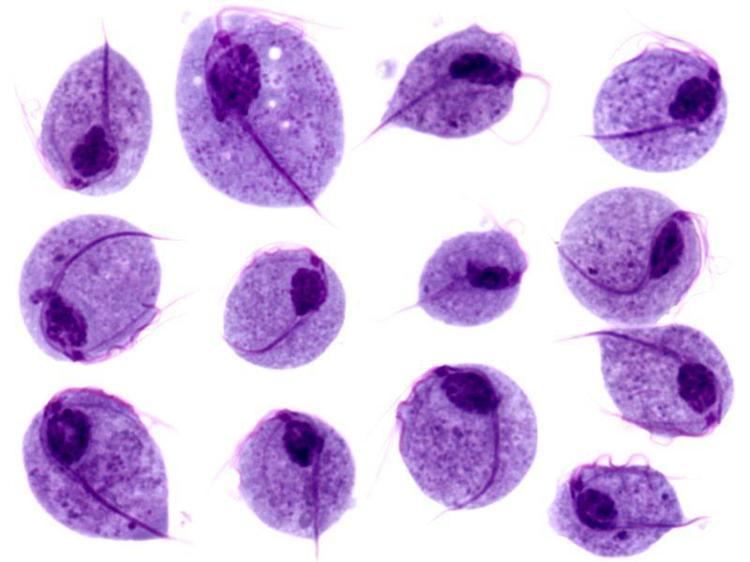 Thirteen Trichomonas vaginalis under the microscope