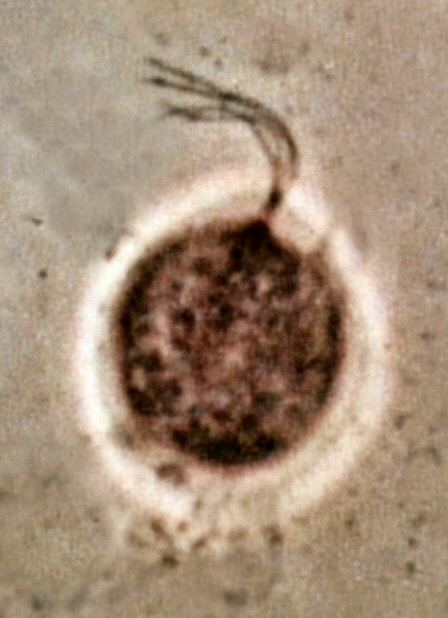Trichomonas vaginalis' phase contrast microscopy