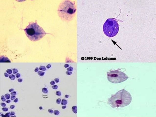 Trichomonas vaginalis under the microscope