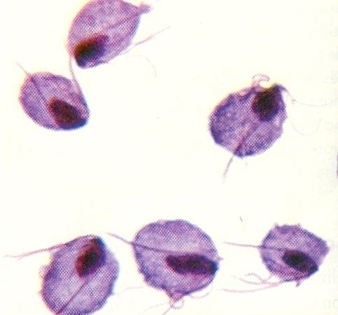 Six Trichomonas vaginalis under the microscope