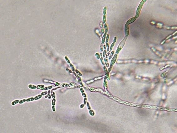 Trichosporon Fun With Microbiology Whats Buggin You Trichosporon species