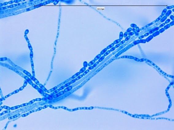 Trichosporon Fun With Microbiology Whats Buggin You Trichosporon species