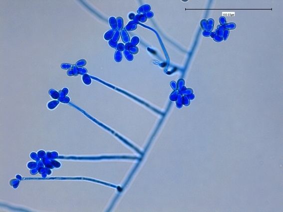 Trichothecium roseum Fun With Microbiology Whats Buggin You Trichothecium roseum