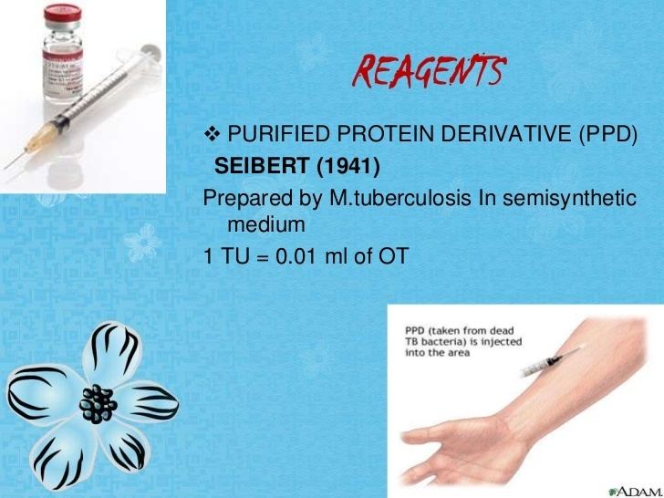 Tuberculin Tuberculin test aman maurya