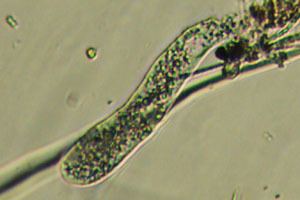 Tubulinea Josh39s microlife Algae from marsh