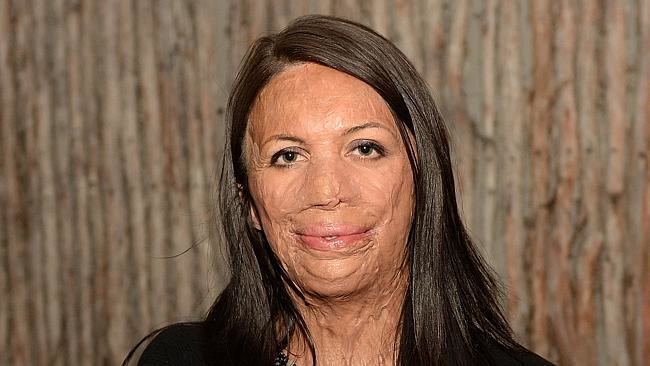 Turia Pitt Turia Pitt posts picture of rescuer hours after winning