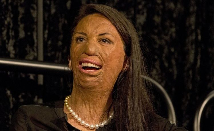 Turia Pitt 010415genturia81ahopuc1ahopuhjpg