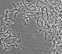Turicibacter httpsuploadwikimediaorgwikipediacommonsthu