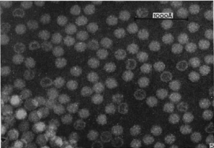 Turnip yellow mosaic virus Electron micrograph of Turnip Yellow Mosaic Virus TYMV Figure
