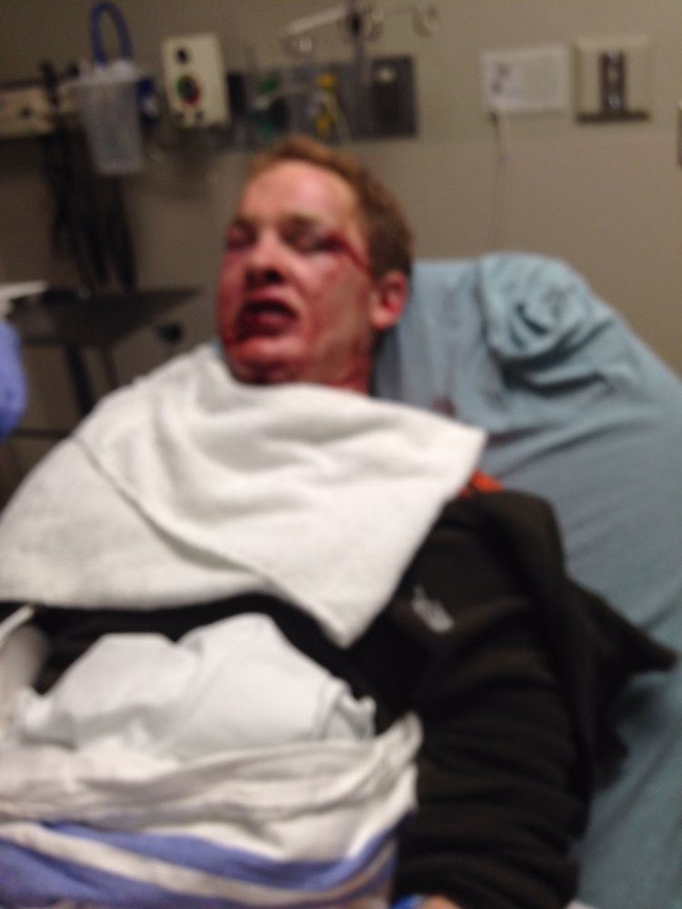 Ty Hensley Attorney releases graphic hospital photos of Ty Hensley