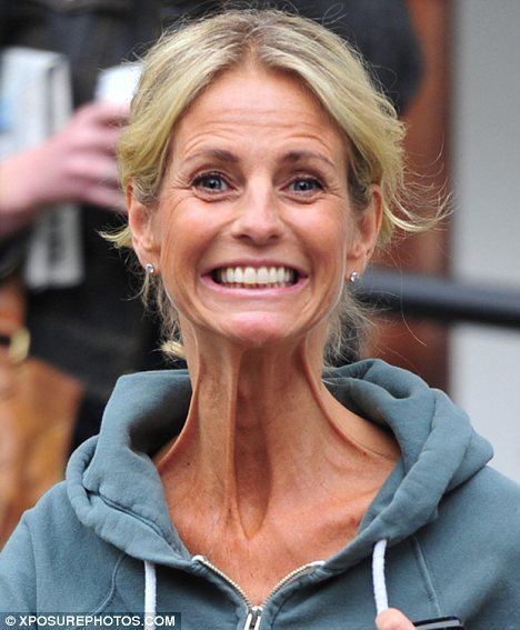 Ulrika Jonsson Ulrika Jonsson fails to hide her shockingly frail and