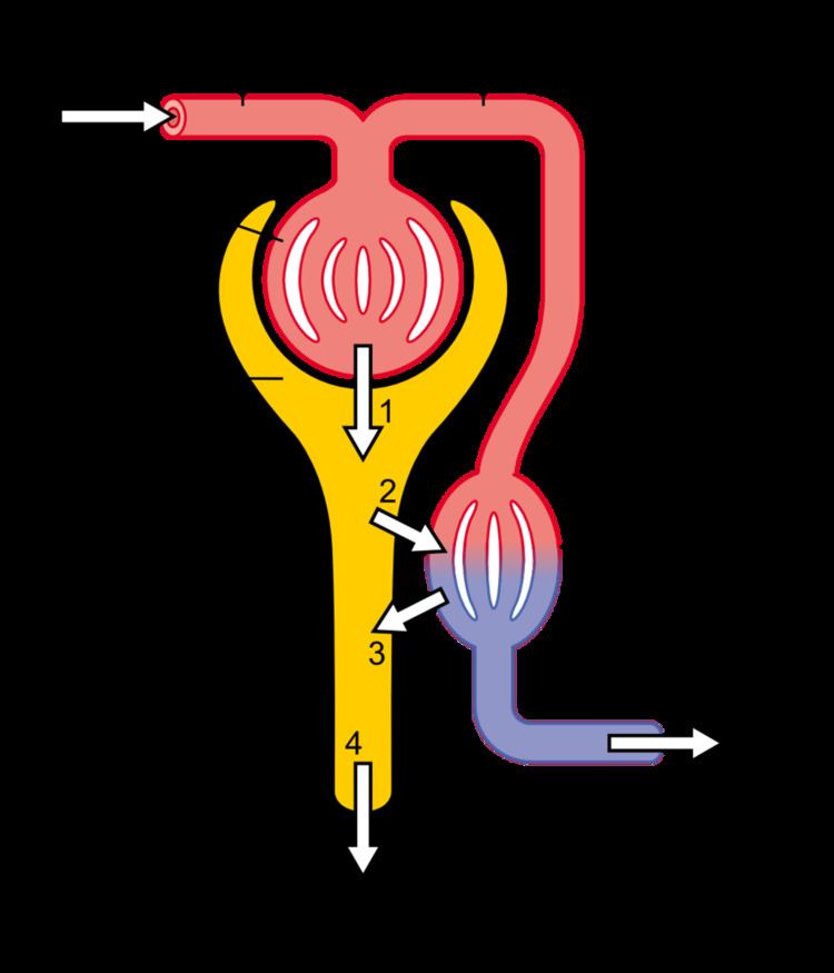 Ultrafiltration (renal)