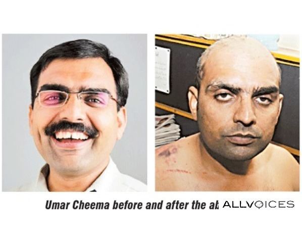 Umar Cheema Umar Cheema Pakistani journalist speaks out after an attack by the
