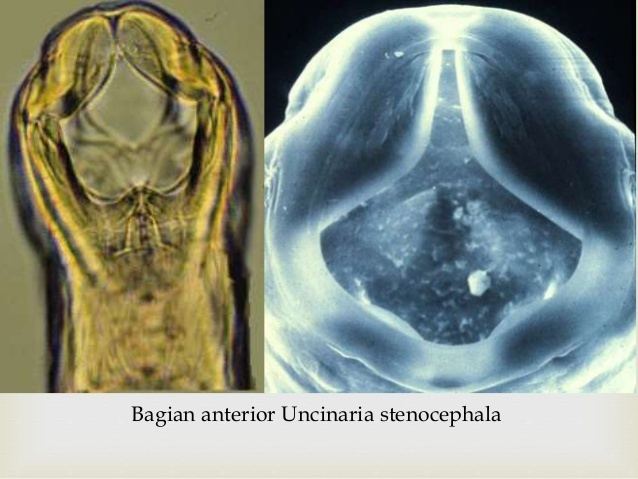 Uncinaria stenocephala httpsimageslidesharecdncomuncinariastenoceph