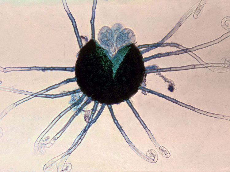 Uncinula necator Uncinula necator squash of cleistothecium showing asci