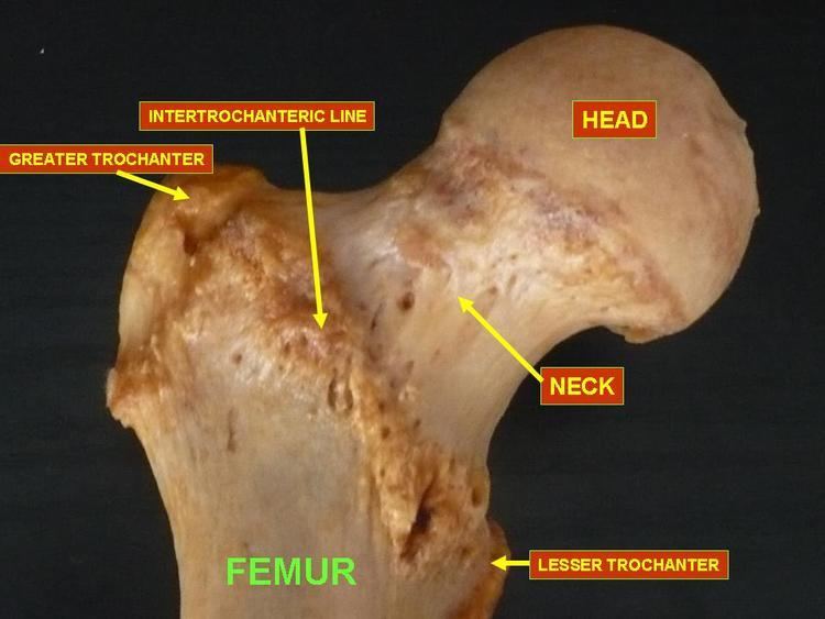 Upper extremity of femur