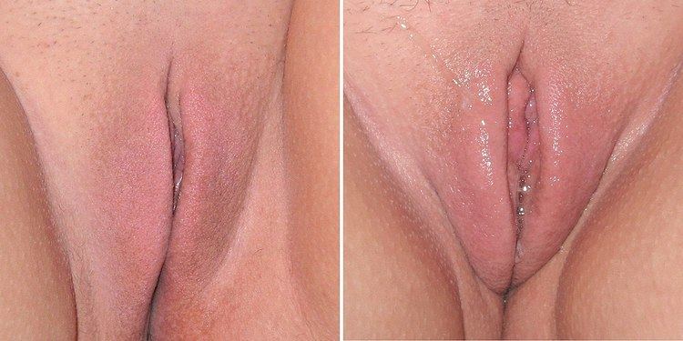 Vaginal lubrication