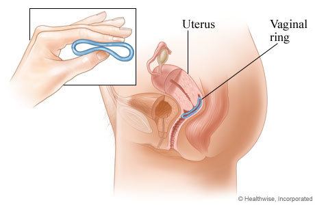 The uterus and vaginal ring