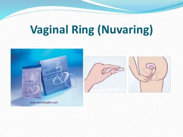 Vaginal ring (Nuvaring)