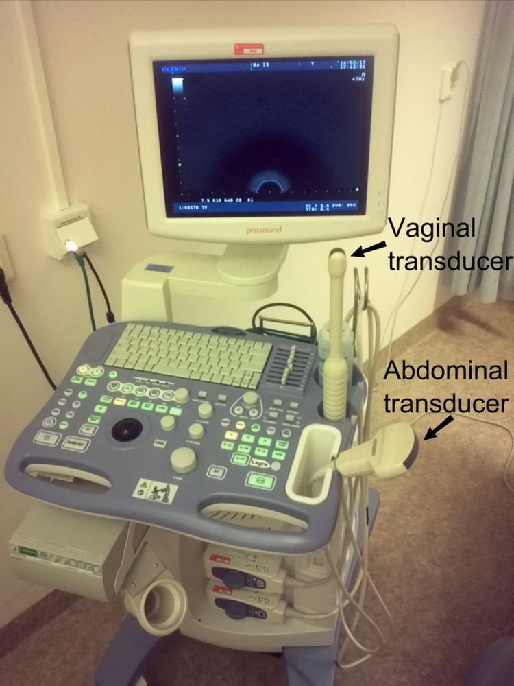 Vaginal ultrasonography