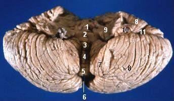 Vallecula of cerebellum