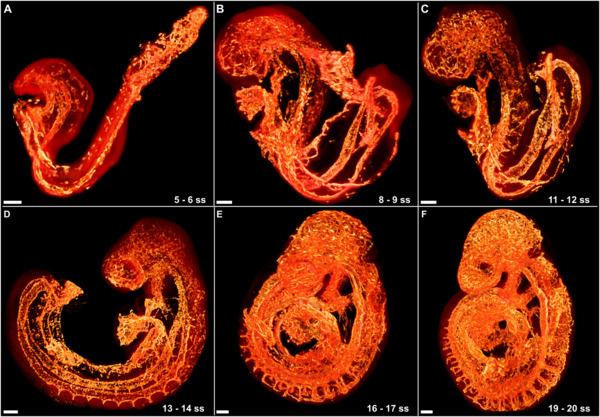 Vascular remodelling in the embryo