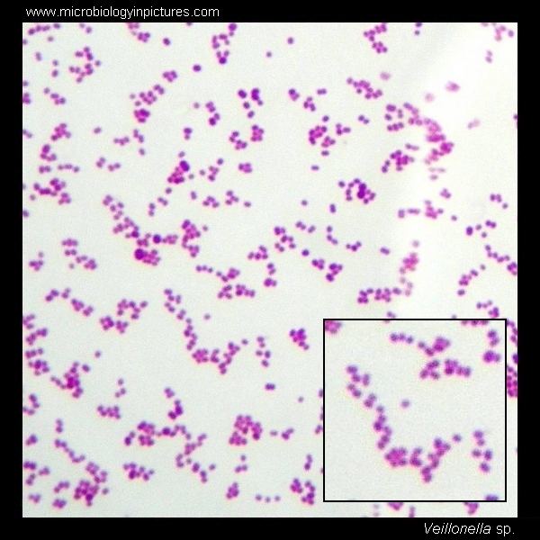 Veillonella Veillonella Gram stain and cell morphology Veillonella micrograph
