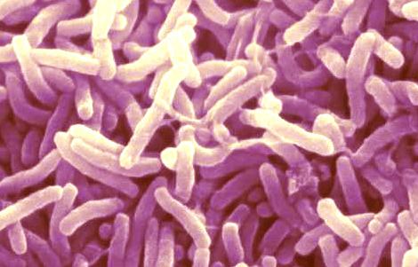 Vibrio Vibrio cholerae Food Science BioRad