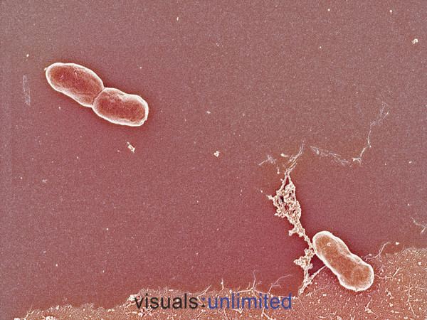 Vibrio mimicus httpsmicrobewikikenyoneduimages119166611jpg