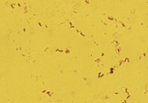 Vibrio natriegens Bacteria and Archaea Clinical Gate