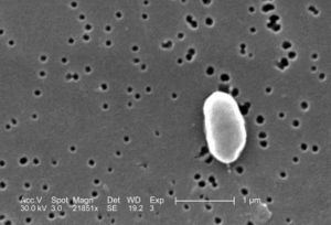 Vibrio parahaemolyticus Vibrio parahaemolyticus MicrobeWiki