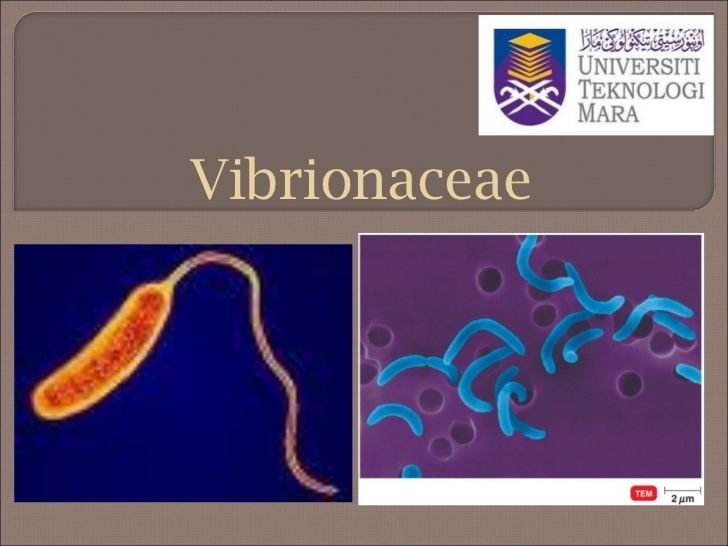 Vibrionaceae httpsimageslidesharecdncomg44vibrionaceae1