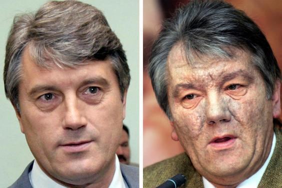 Viktor Yushchenko Viktor Yushchenko Every politician in Ukraine who turns to the