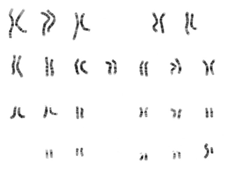 Virtual karyotype